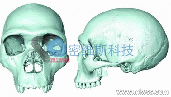 头骨扫描